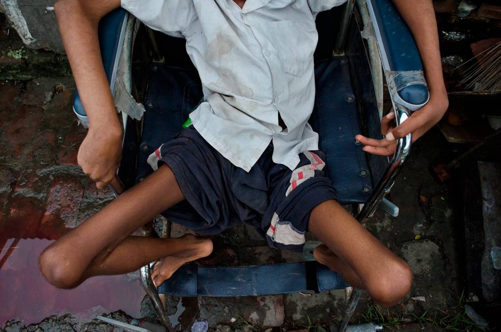 Tshuapa : un cas de poliovirus sauvage détecté dans la zone de santé de Boende